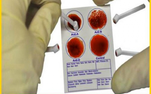 Установлена четкая связь между группой крови и онкологическими рисками