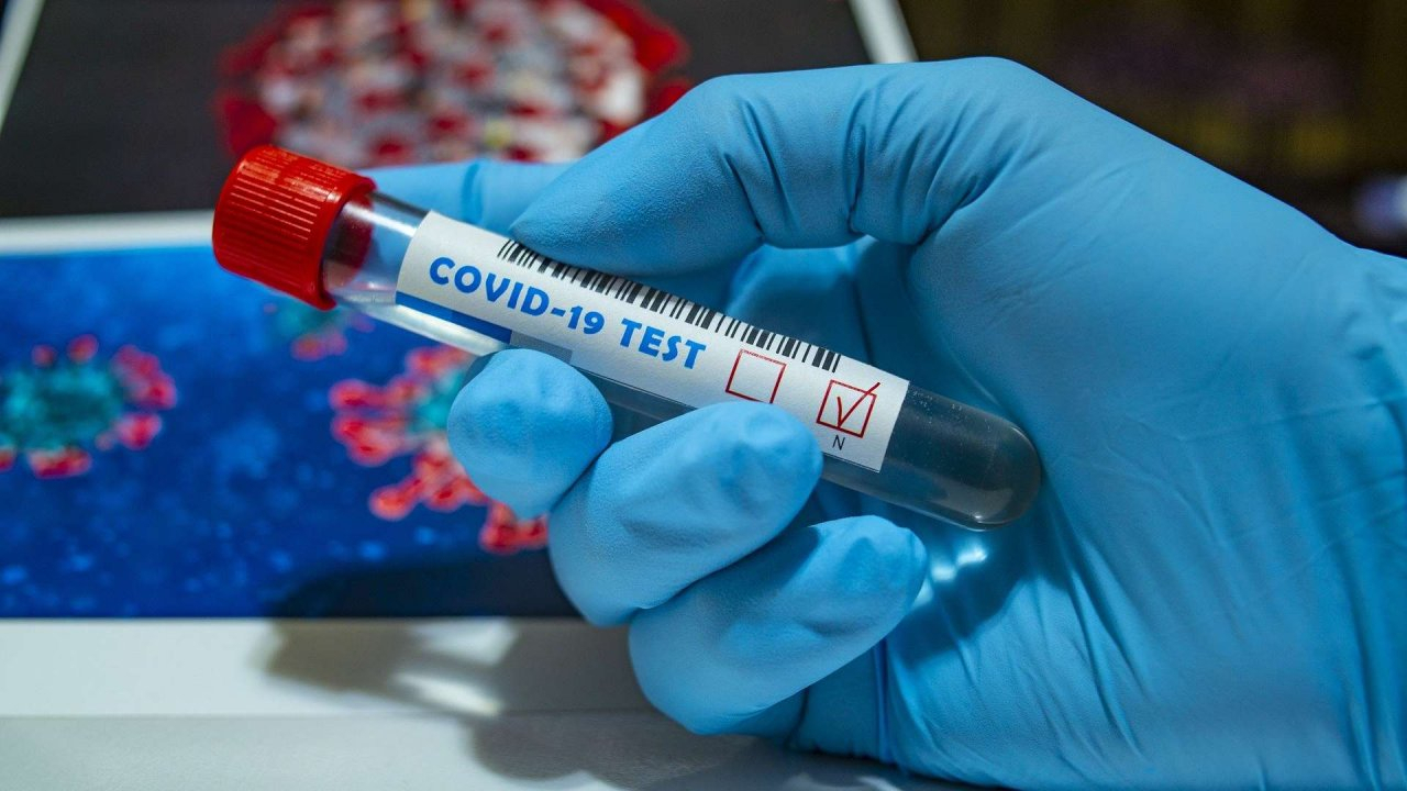 Во Владимирской области еще 21 человек заразился коронавирусом