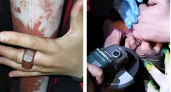 Во Владимире 11-летний мальчик засунул палец в приваренную к столбу гайку и не мог выбраться 